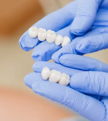 Dental Crowns at Southern Prosthodontics in Saltillo, MS